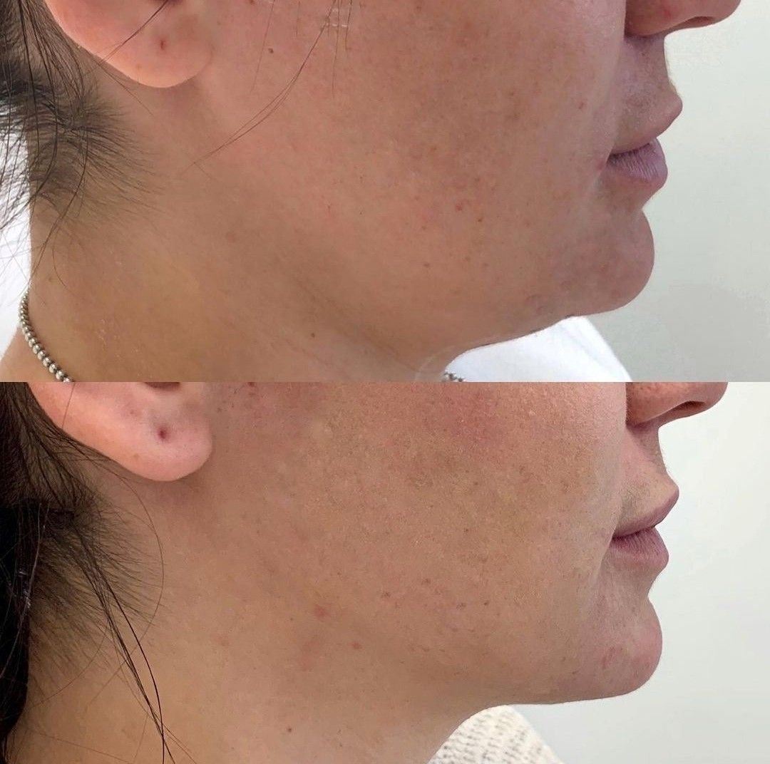 GlowLift™ — Reafirma, Deshincha y Rejuvenece tu Piel al Instante